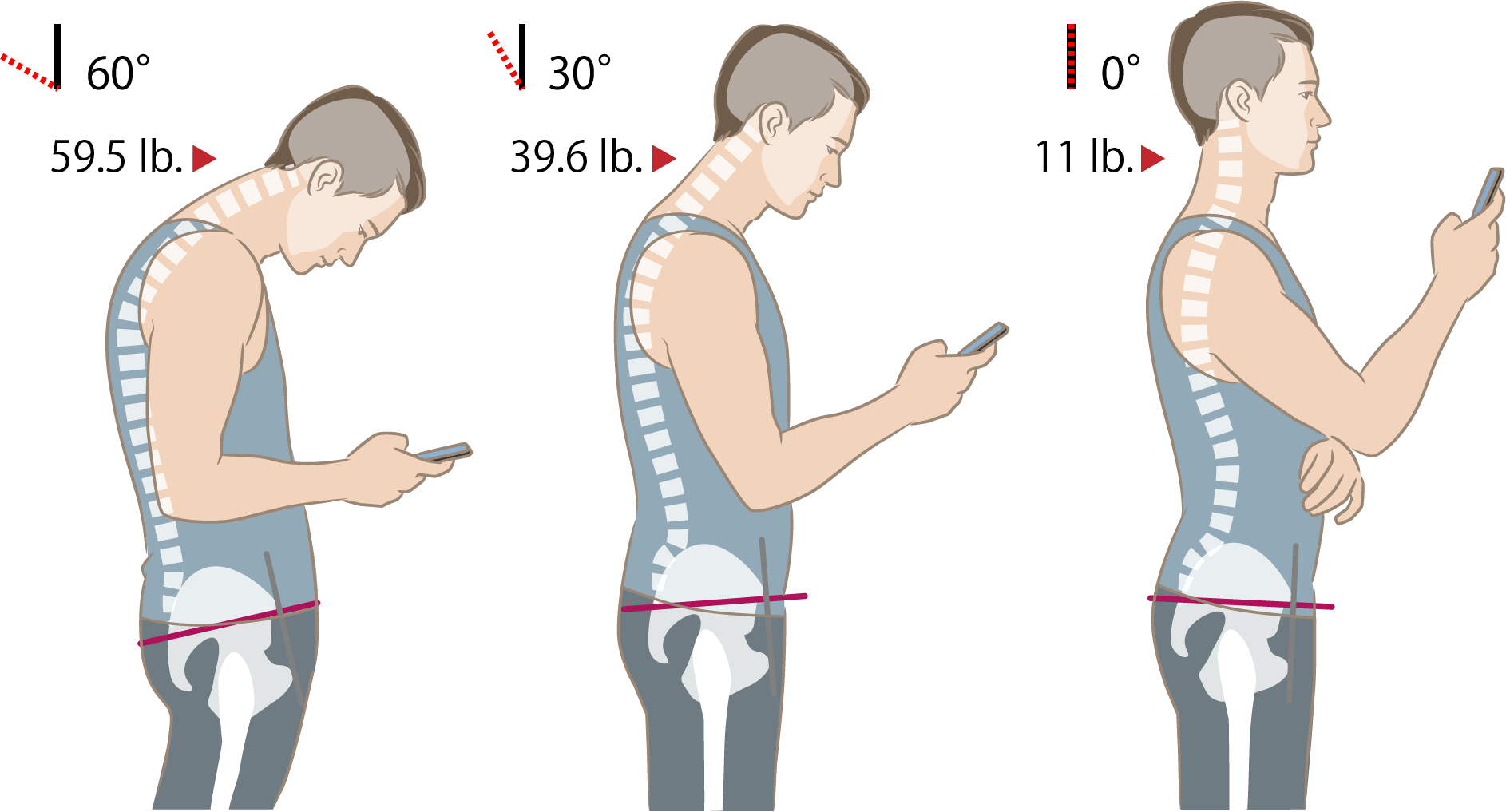 Tech Neck Illustration Right